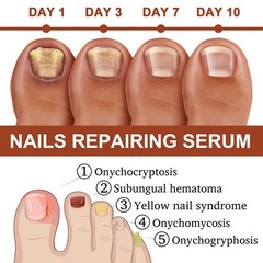 7 Days Nail Care ence Grey Nail Hand Foot Nail Nutrit