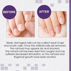 Nail Tek #4 Nail Hydrate for Weak, Damaged Nail Moisturizing Strengthener 0.5oz