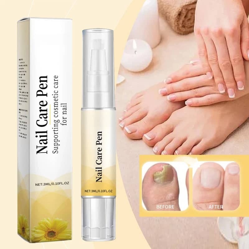 Onychomycosis Care Solution Pen Gently Repairs Strengthens and Thickens Nail 3ML