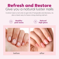 Cuticle Remover Kit with Cream Oil Tools & Trimmer for Nail Care Manicure