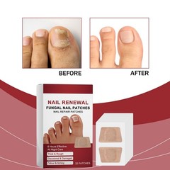 32Pcs Fungal Nail Repair Patch Nail Care Soft Nail Inlay Nail Correction Sticker