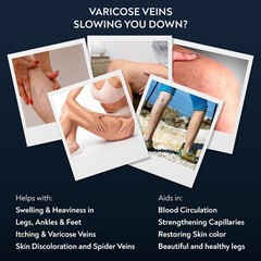 Varicose & Spider Vein Cream for Men & Women | Ayurvedic Ashwagandha Formula for
