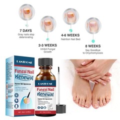 ANTI FUNGAL NAIL REPAIR LIQUID INFECTION ANTIBACTERIAL TOE FINGER TREATMENT-AU