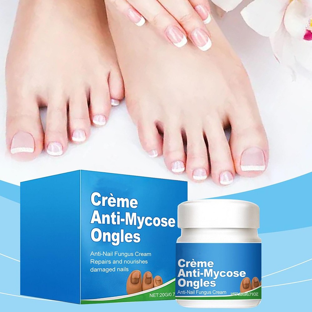 20g Nail Care Cream – Anti-Ingrown, Strengthen & Restore Nail Health