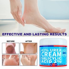 ASDToTio Urea Cream 42% – Premium Foot 4 Ounce (Pack of 1), white
