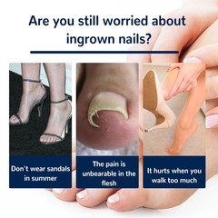 Nail Correction Patch, Nail Insert Correction And Repair Toe Manicure Nail Patch