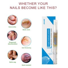 Nail Repair Oil for Fungal & Yellow Nails Treatment, Strengthens