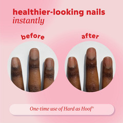 Onyx Professional Hard as Hoof Nail Strengthening 1 Ounce (Pack of 1), White