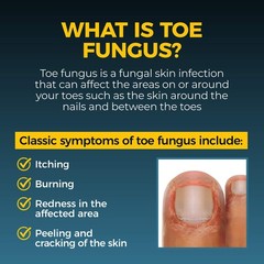 Fungi-Nail Pen Applicator Anti-Fungal Solution, 0.101 Fl Oz (Pack of 1),