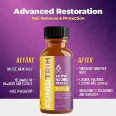 FungiTrim Nail Renewal Serum 1oz – Natural Botanical Formula Supports Healthy Na
