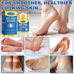 Urea Foot Care Cream, Cream 60 Percent for Feet 1.41 Ounce (Pack of 1)