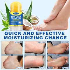 Urea Foot Care Cream, Cream 60 Percent for Feet 1.41 Ounce (Pack of 1)