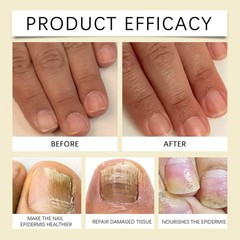 Nail Care Liquid Hand and Foot Nail Corneous Soft Nail