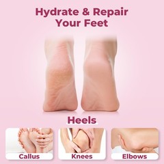 SAISZE Urea Cream 40 Percent for Feet Maximum 5.29 Ounce (Pack of 1)