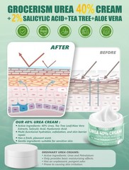 Grocerism Urea Cream 40 Percent For Feet Plus 2% 5.29 Ounce (Pack of 1), 40%