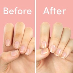 ella+mila “First Aid Kiss” Nail Strengthener and Growth treatment- Nail…