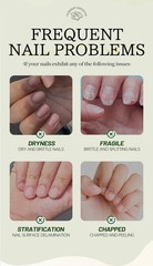 2 Pack Nail Nutrient Solution Nail &amp; Cuticle Care Oil Moisturizing 30ml