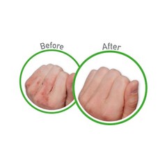 O’Keeffe’s Working Hands Hand Cream for Extremely Dry, Cracked Hands, 3.4 Ounce