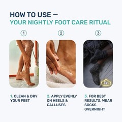 Urea Cream 40 Percent for Feet Maximum Strength 4.3 Fl Oz (Pack of 1), White