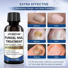 Toenail Fungus Treatment Extra Strength 2 Fl Oz (Pack of 1), blue – 2PACK