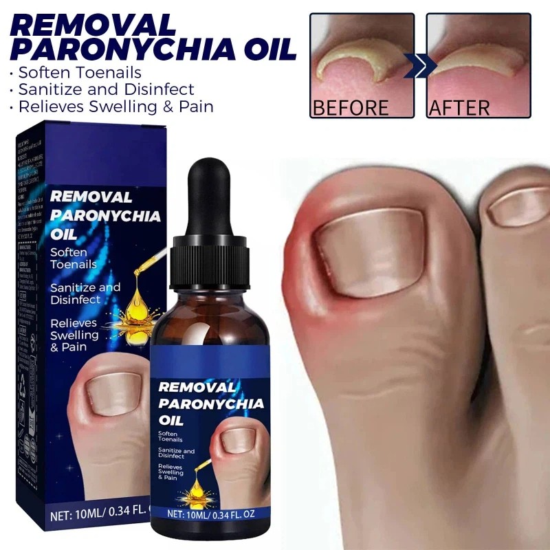 Nail Care Oil for Fingernails & Toenails Cuticle Repair Moisturizing Nourishment
