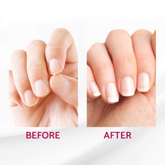 IBD Reconstrux Nail Repair Treatment – Nail Strengthener for Weak & Damaged Nail
