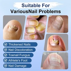 Toenail Fungus Treatment Extra Strength, Fungi 0.02 Fl Oz (Pack of 9), 9pcs