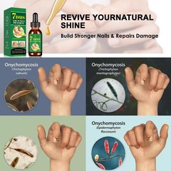 Natural Fingernail Essence Oil Nail Growth Strengthener Fungus Treatment Care