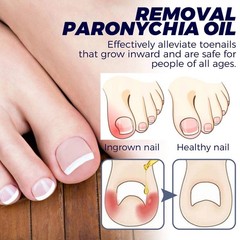 Nail Daily Care Oil for Ingrown Toenails on Hands Feet Toenails Anti Fungal