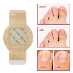 21PCS Nail Fungus Treatment For Toenails Nail Repair & Fungal Treatment Patches