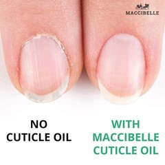 Cuticle Oil For Nails Refill size for Dry Cracked Cuticles 4 Ounce, Pineapple