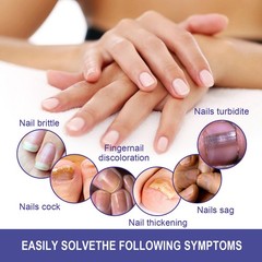 Nail Repair Lotion, Repair Thickening Nail Inlay Gray Nail Shine Soft Nail Care