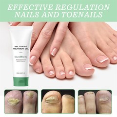 Nutraboost Nail Fungus Treatment Gel, Nail Fungus, Fungus Cream NEW 2026