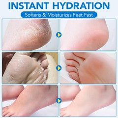 Uruses Urea Cream 60% plus Salicylic Acid 2% Foot 1.41 Fl Oz (Pack of 1)
