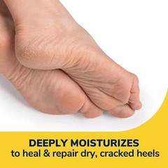 Dr. Scholl’s Severe Cracked Heel Repair Restoring Balm 2.5 Ounce (Pack of 1)