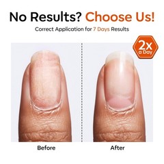 Natural Organic Nail Care – Clear Strengthener & Growth Oil for Damaged Nails