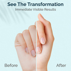 Cuticle & Nail Cream Treament, Deep Nourishing – USA Made – Daily Repair Nail Ca