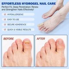 21PCS Nail Fungus Treatment For Toenails Nail Repair & Fungal Treatment Patches