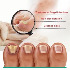 Nail Repair Serum Strengthening Nail Care Solution Nourishing Cuticle Oil