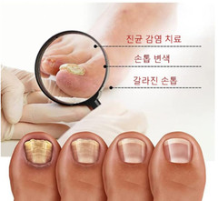 KORELAN Anti-Fungal Nail Repair Treatment Essence 20 ml Recuperative in 7 Days