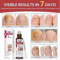 QQE Fungal Nail Treatment 7 Days+ Cream 1% Tolnaftate 0.51 fl oz / 15 ml