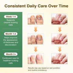 SafeFight Toenail Fungus Treatment Extra Strength – 3PCS Nail Repair