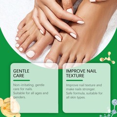 Nail Repair Serum – Softens Cuticles, Corns, and uses on