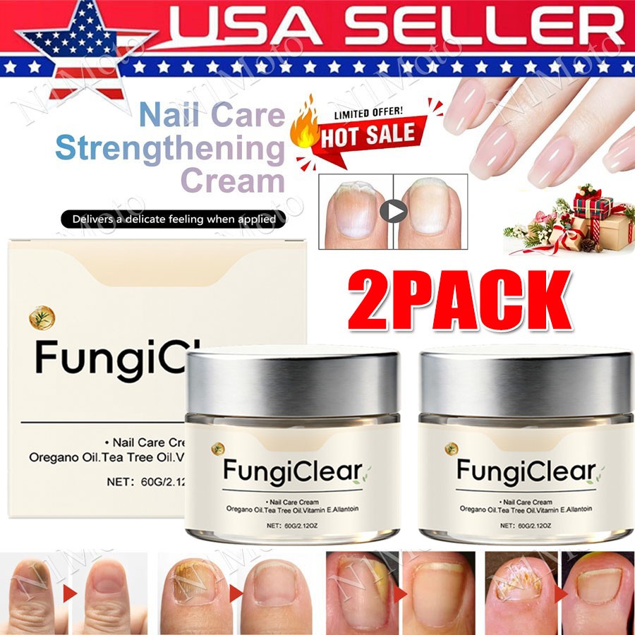 2PCS-FungiClear Nail&Toenail Fungus Care Cream W/Oregano Oil,Vitamin E&Allantoin