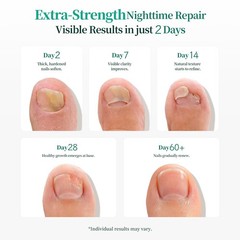 APUREE Fungal Nail Patches Extra Strength: Max 1% Tolnaftate 32 Patch, CLEAR