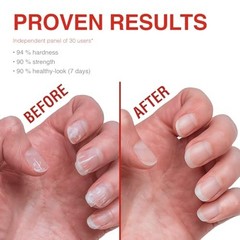 Natural Nail Strengthener & Growth Treatment – Clear Polish for Weak, Damaged Na
