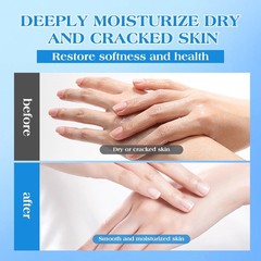 42% Urea Cream for Dry & Cracked Skin – Foot & Hand 5.3 Fl Oz (Pack of 1)