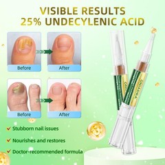 Toenail Fungus Treatment Pen Extra Strength – 0.17 Fl Oz (Pack of 6), White