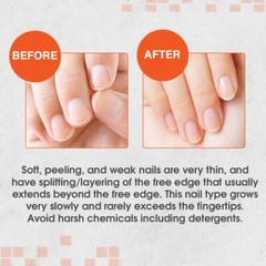 NailTek Strengthener 2 Intensive Therapy – For Soft & Peeling Nails