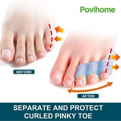 Povihome 10 Pack Pinky Toe Separator and 10 Count (Pack of 1), Blue
